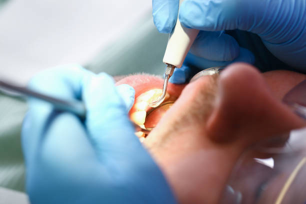 Best Emergency Dental Surgery in Butler, IN