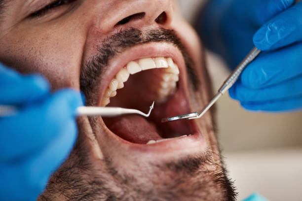 Best Same-Day Emergency Dentist in Butler, IN