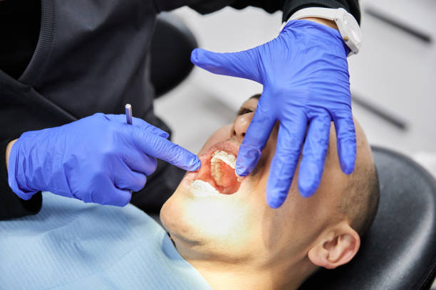 Best Walk-In Emergency Dentist in Butler, IN